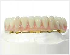 Implant
